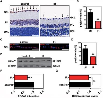 Reduced Annexin A1 Secretion by ABCA1 Causes Retinal Inflammation and Ganglion Cell Apoptosis in a Murine Glaucoma Model